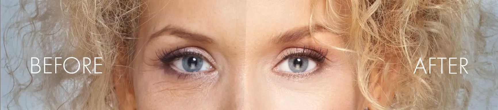 Before After Single Image