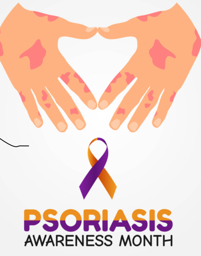 Psoriasis and Mental Health: How Science, Skincare, and Support Work Together