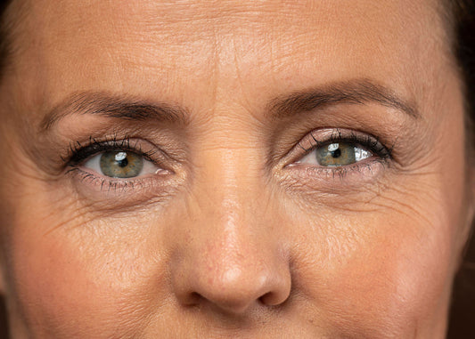 Dehydration Wrinkles: A Beginner’s Guide