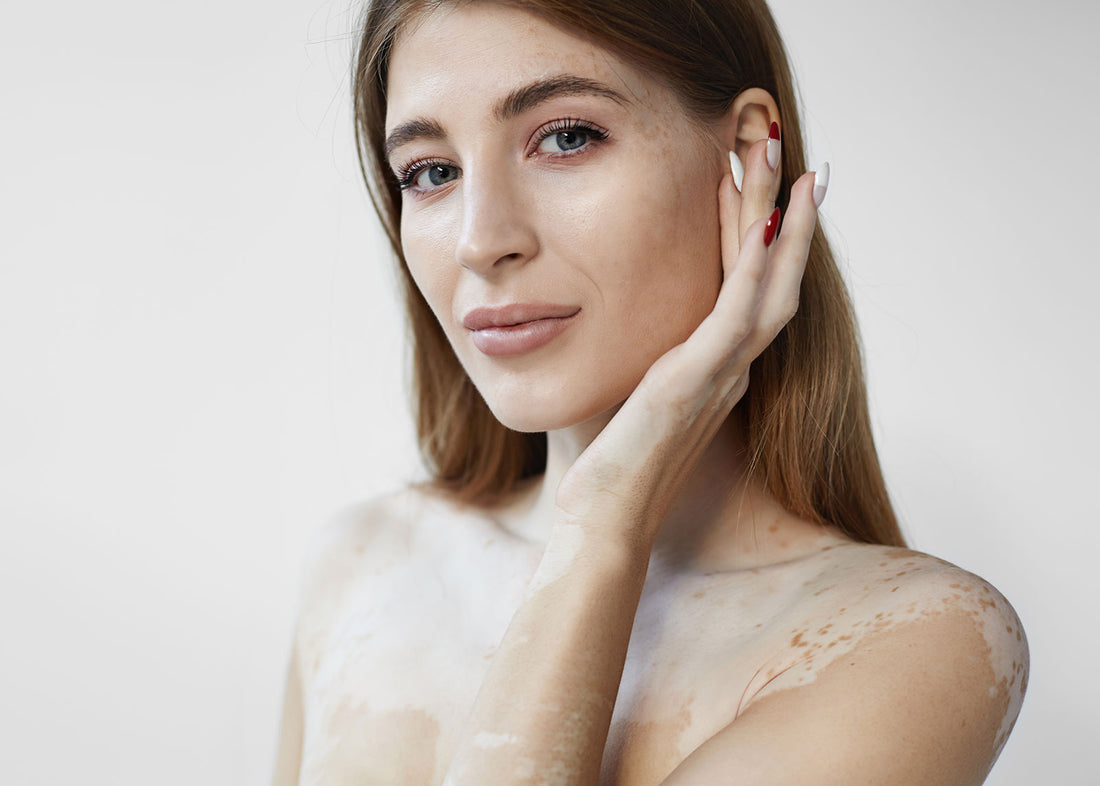 Dry Skin vs Dehydrated Skin: Are There Differences?