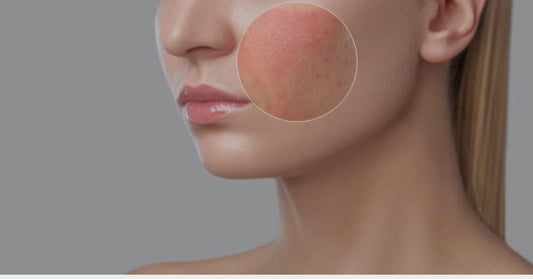 Inflammation-Focused Wellness: Managing Chronic Inflammation for Body and Skin Health