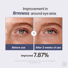 Before and after results showing improvement in firmness around the eye area using Lifting & Firming Eye Crème after 2 weeks of use. Luxury anti-aging eye cream formulated with peptides, hyaluronic acid, green tea, shiitake mushroom extract, and squalene to visibly smooth fine lines, hydrate dry under eyes, reduce puffiness, and improve skin firmness for a youthful radiant complexion.