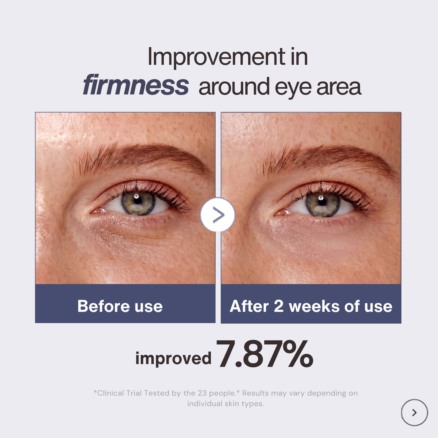 Before and after results showing improvement in firmness around the eye area using Lifting & Firming Eye Crème after 2 weeks of use. Luxury anti-aging eye cream formulated with peptides, hyaluronic acid, green tea, shiitake mushroom extract, and squalene to visibly smooth fine lines, hydrate dry under eyes, reduce puffiness, and improve skin firmness for a youthful radiant complexion.