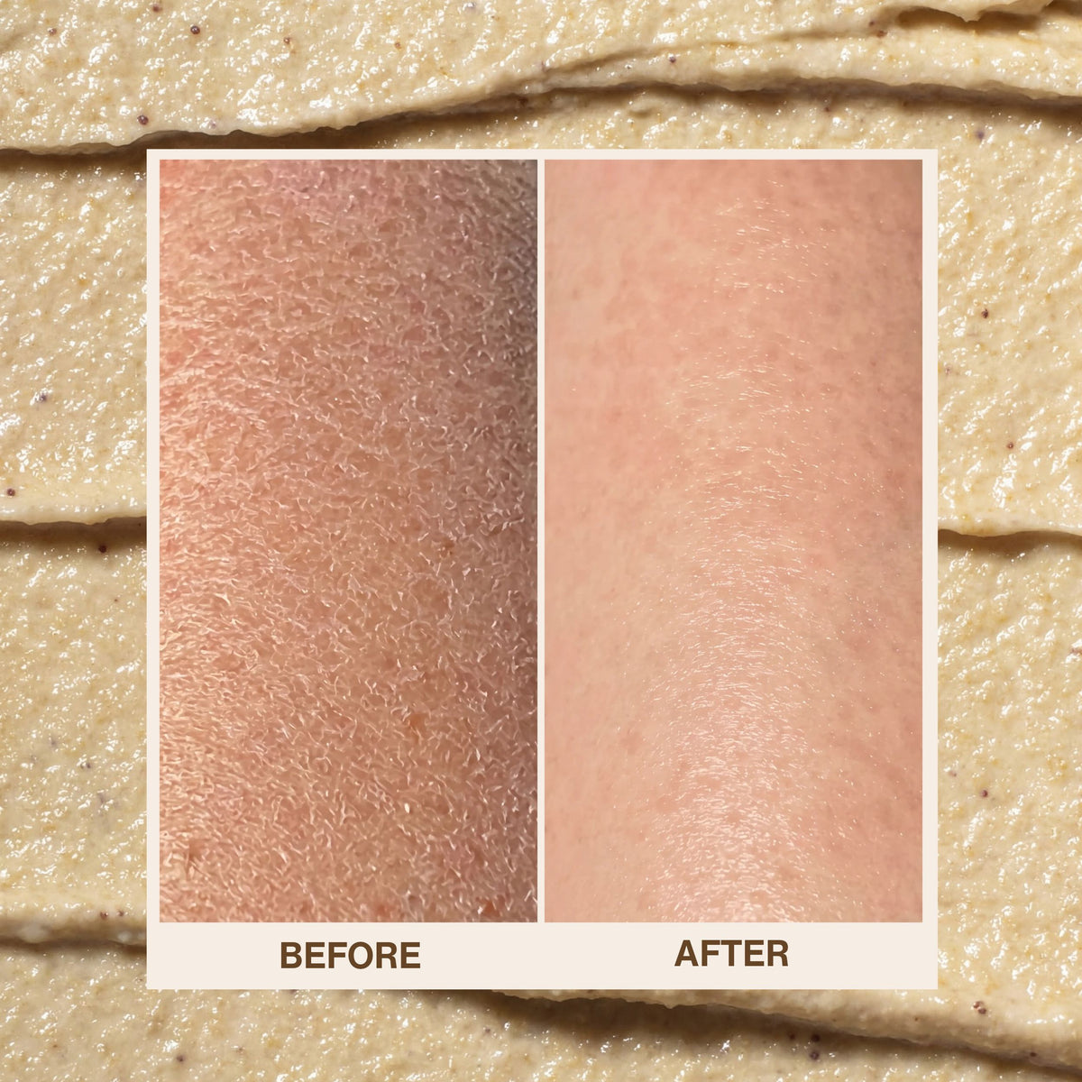 Before and after using Trilipiderm Hydrating Exfoliant Cleanser: dry, rough, flaky skin looks smoother, softer and more hydrated, shown over the cleanser’s exfoliating scrub texture.