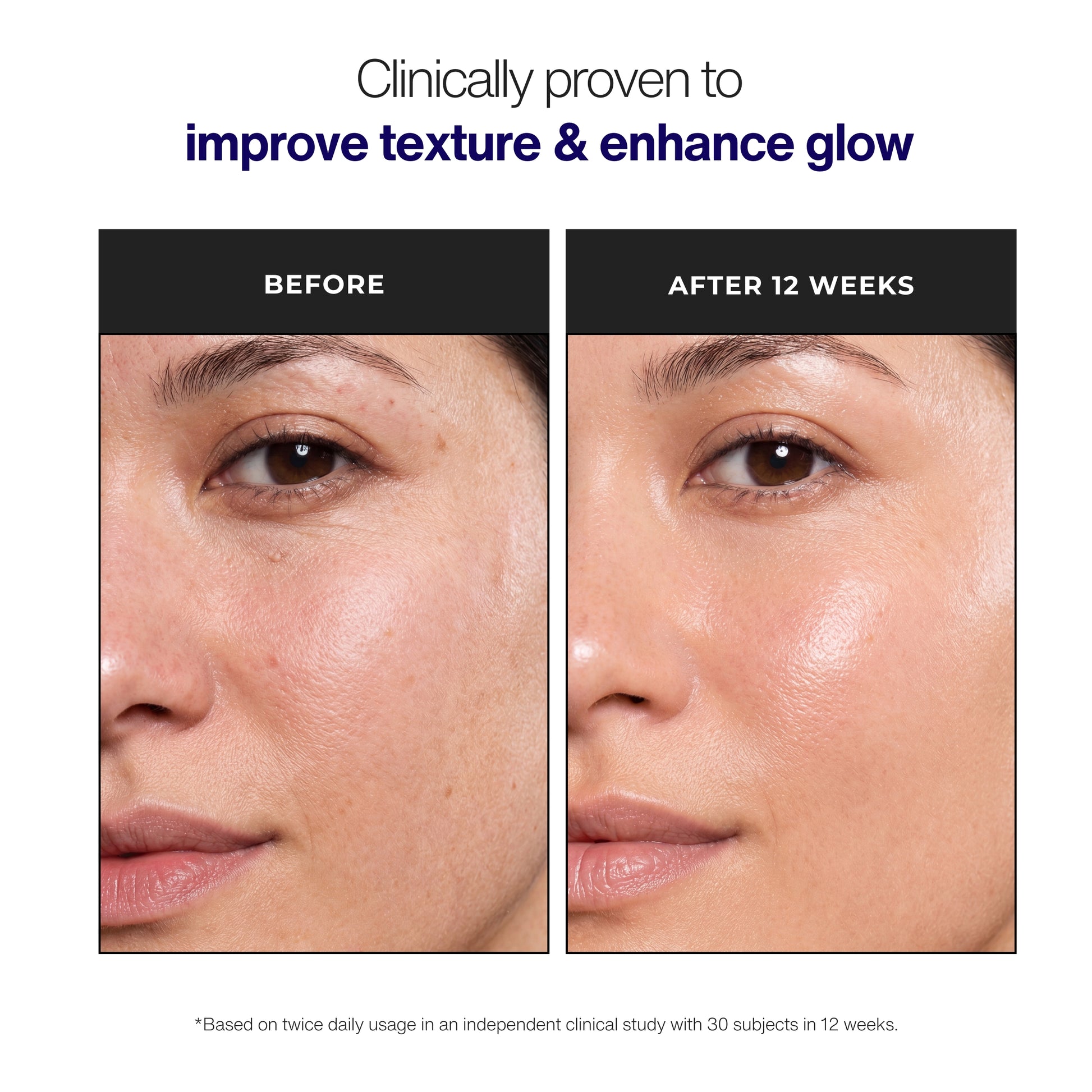 Trilipiderm Rehydration Night Crème skincare benefits graphic with creamy moisturizer texture applied to skin, highlighting intense hydration, bouncy glow, fine line and wrinkle care, cellular renewal support, and barrier repair for a healthier-looking overnight complexion.