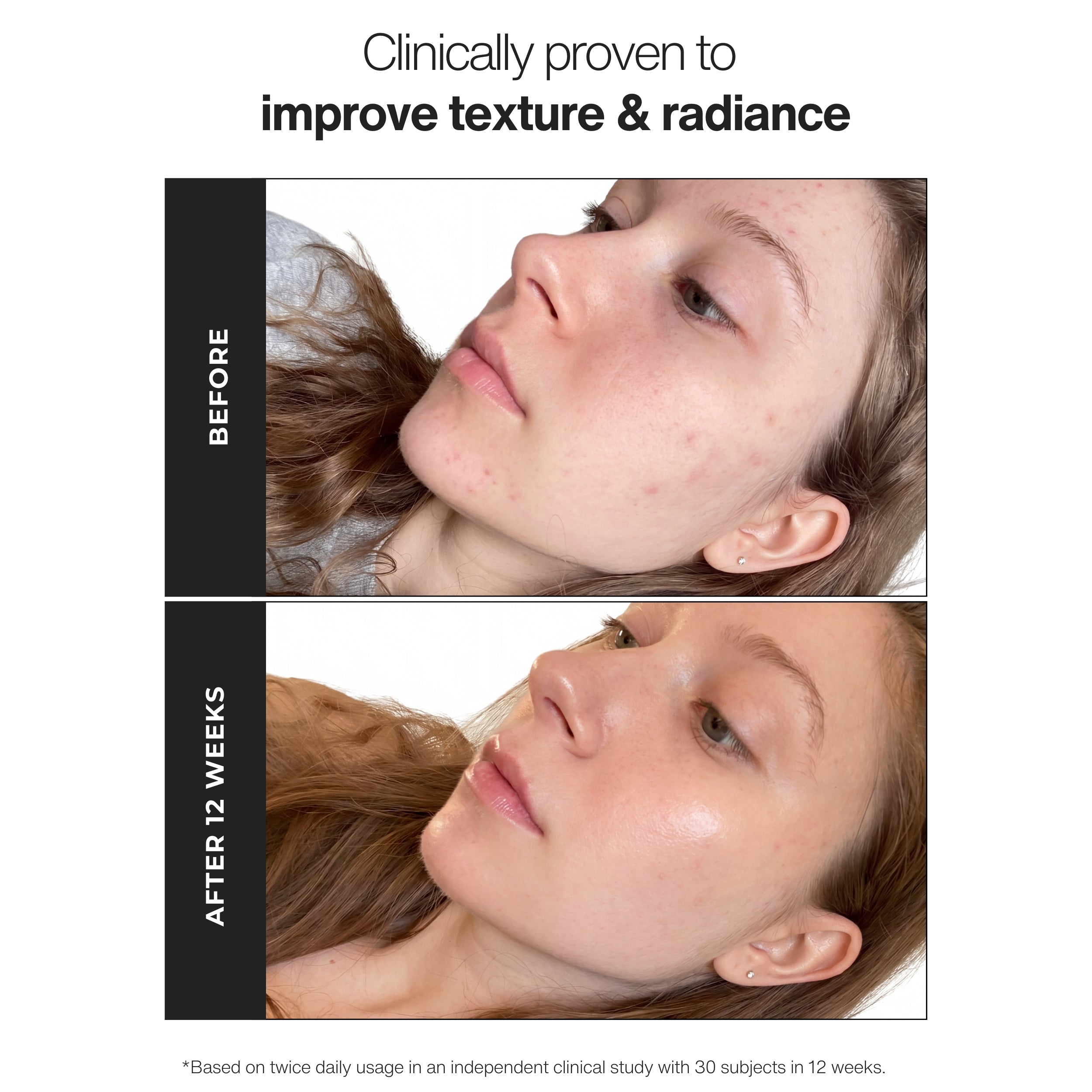 Triple Vitamin C Brightening Serum | Trilipiderm 36-Hour Radiance