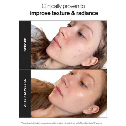 Trilipiderm Skincare Triple Vitamin C Brightening Serum before and after skincare results showing smoother-looking texture, improved radiance, more even-looking skin tone, healthy glow, glass skin finish, and visible brightening benefits.
